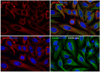SQSTM1 Antibody