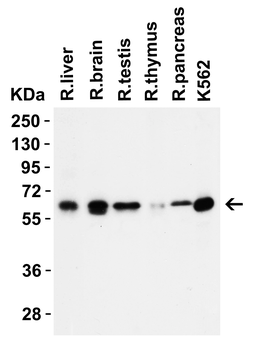 SQSTM1 Antibody