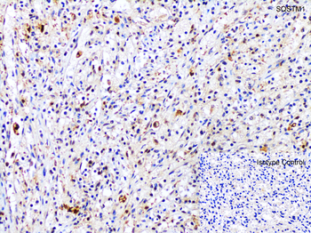 SQSTM1 Antibody