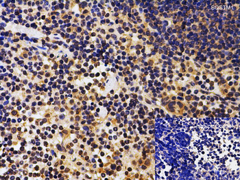 SQSTM1 Antibody