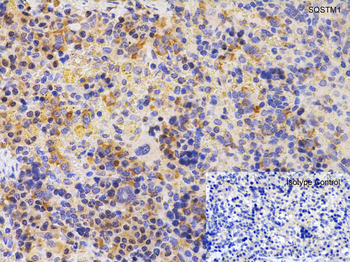 SQSTM1 Antibody