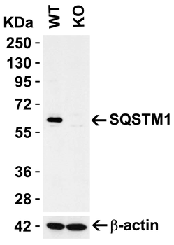 SQSTM1 Antibody