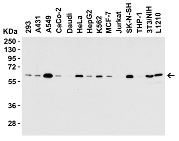 SQSTM1 Antibody