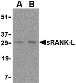 TNFSF11 Antibody