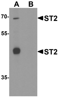 Il1rl1 Antibody