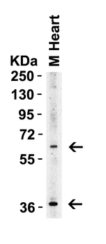 Il1rl1 Antibody