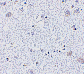 BRSK1 Antibody