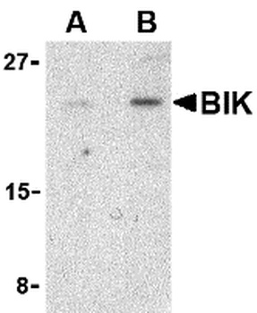 BIK Antibody