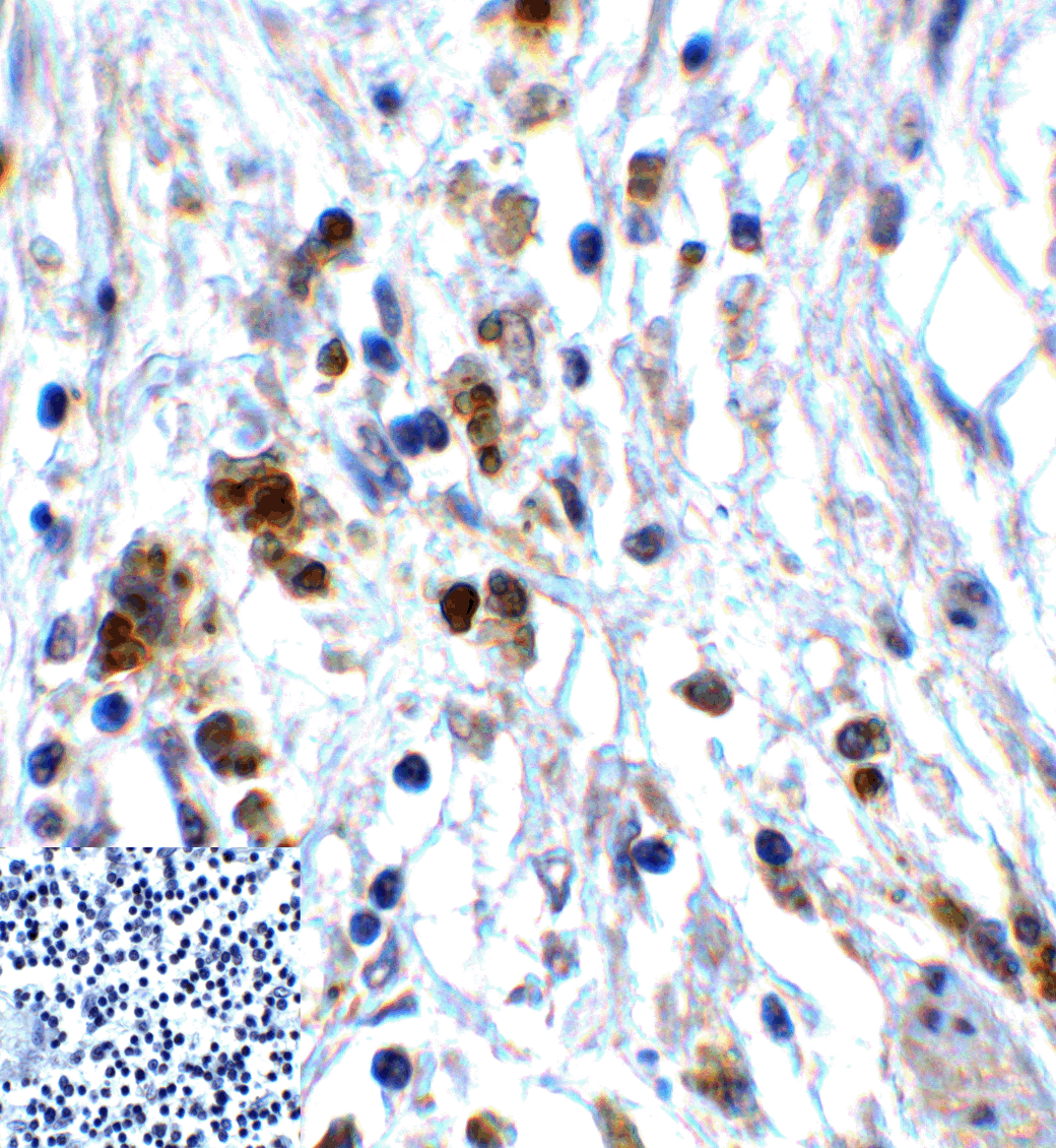 TIGIT Antibody