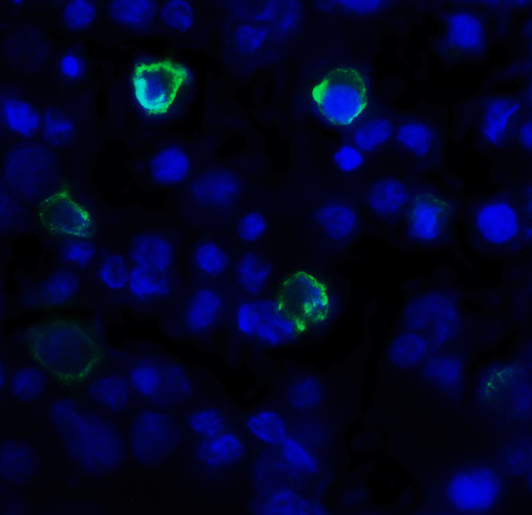 TIGIT Antibody