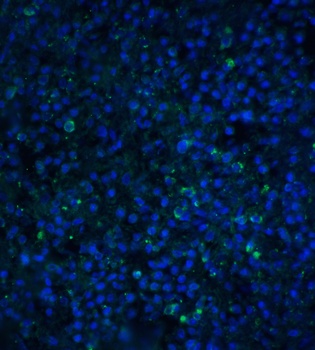 TIMD4 Antibody