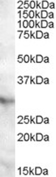 IFNAR2 Antibody