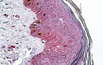 PNPLA2 Antibody
