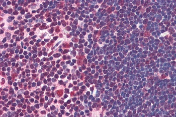 ILF2 Antibody