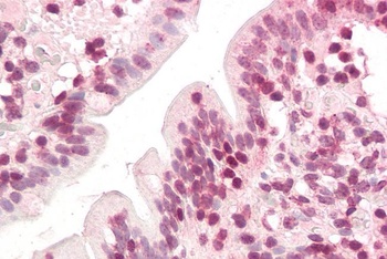ZIC5 Antibody