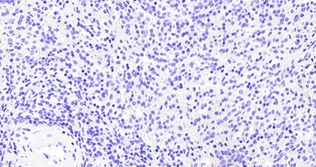 VAV3 Antibody