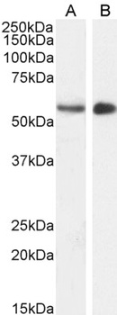 STK35 Antibody
