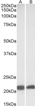 CAV3 Antibody