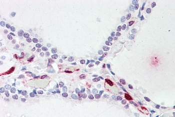 Lcn2 Antibody
