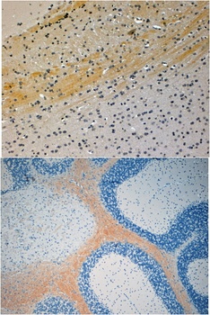 MAPK8IP3 Antibody