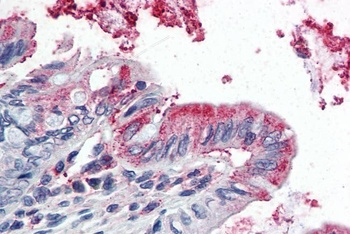 GPX3 Antibody