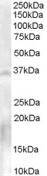 DDC Antibody