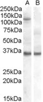 CCKBR Antibody