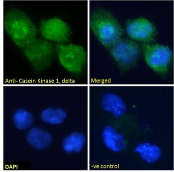 CSNK1D Antibody
