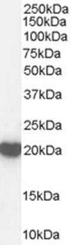 CSNK1D Antibody
