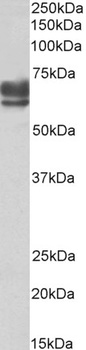 CSNK2B Antibody