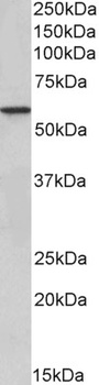 CSNK2B Antibody