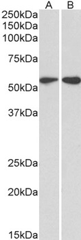 CD3-ZETA/CD247 Antibody