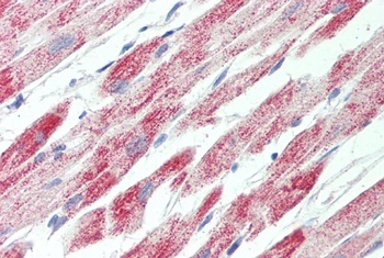 tropomyosin 4/TPM4 Antibody