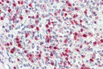 NR5A2/LRH1 Antibody