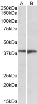EEF1E1/AIMP3/p18 Antibody