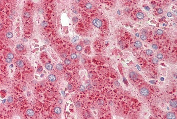 MK2/MAPKAPK2 Antibody