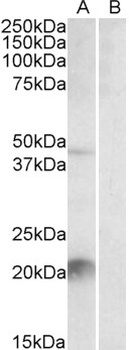 Afamin/alpha Albumin Antibody