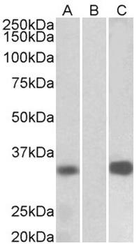 AIMP1 Antibody