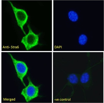 RCAN1 Antibody