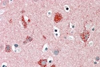 STXBP1 Antibody