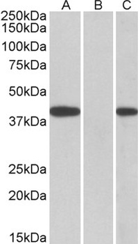CYP24A1 Antibody