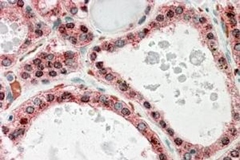 FBN1 Antibody