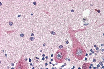RCBTB2 Antibody