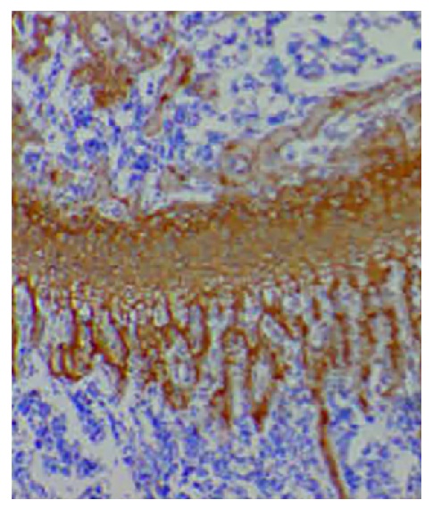 Type II Collagen Antibody