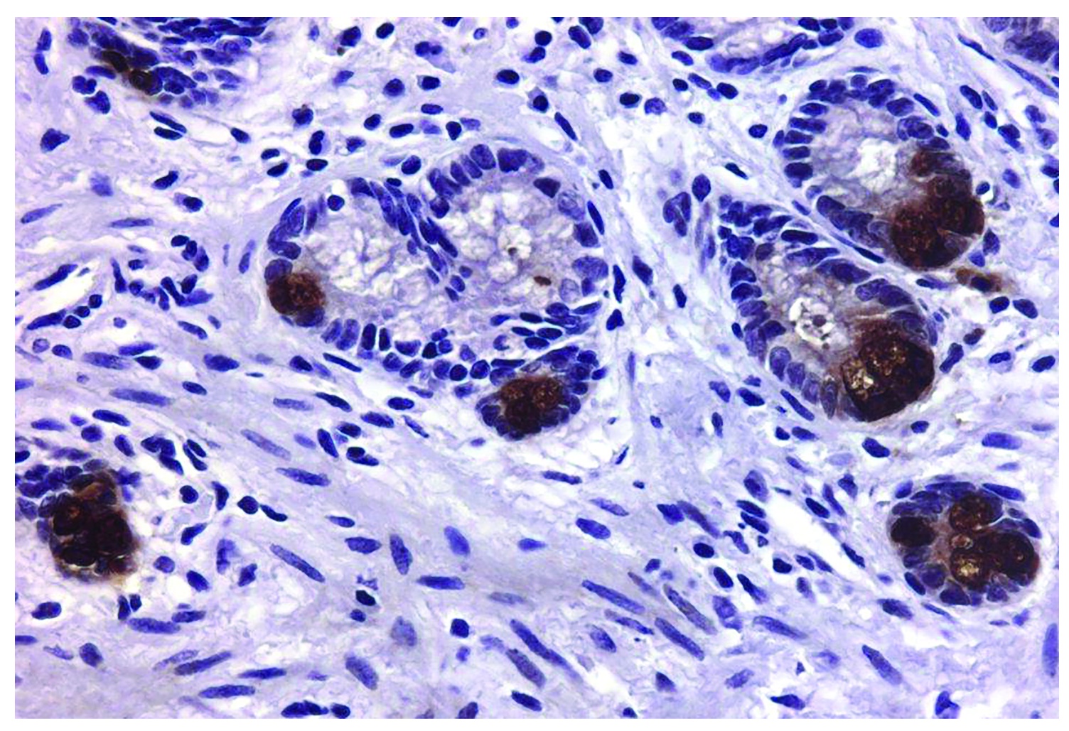 MMP9 Antibody