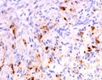 TNF Antibody
