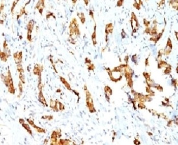 HSPB1 Antibody
