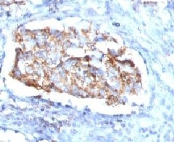 HSPD1 Antibody