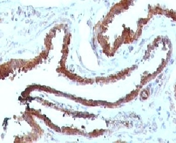 HSPB1 Antibody