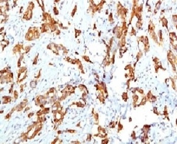 HSPB1 Antibody